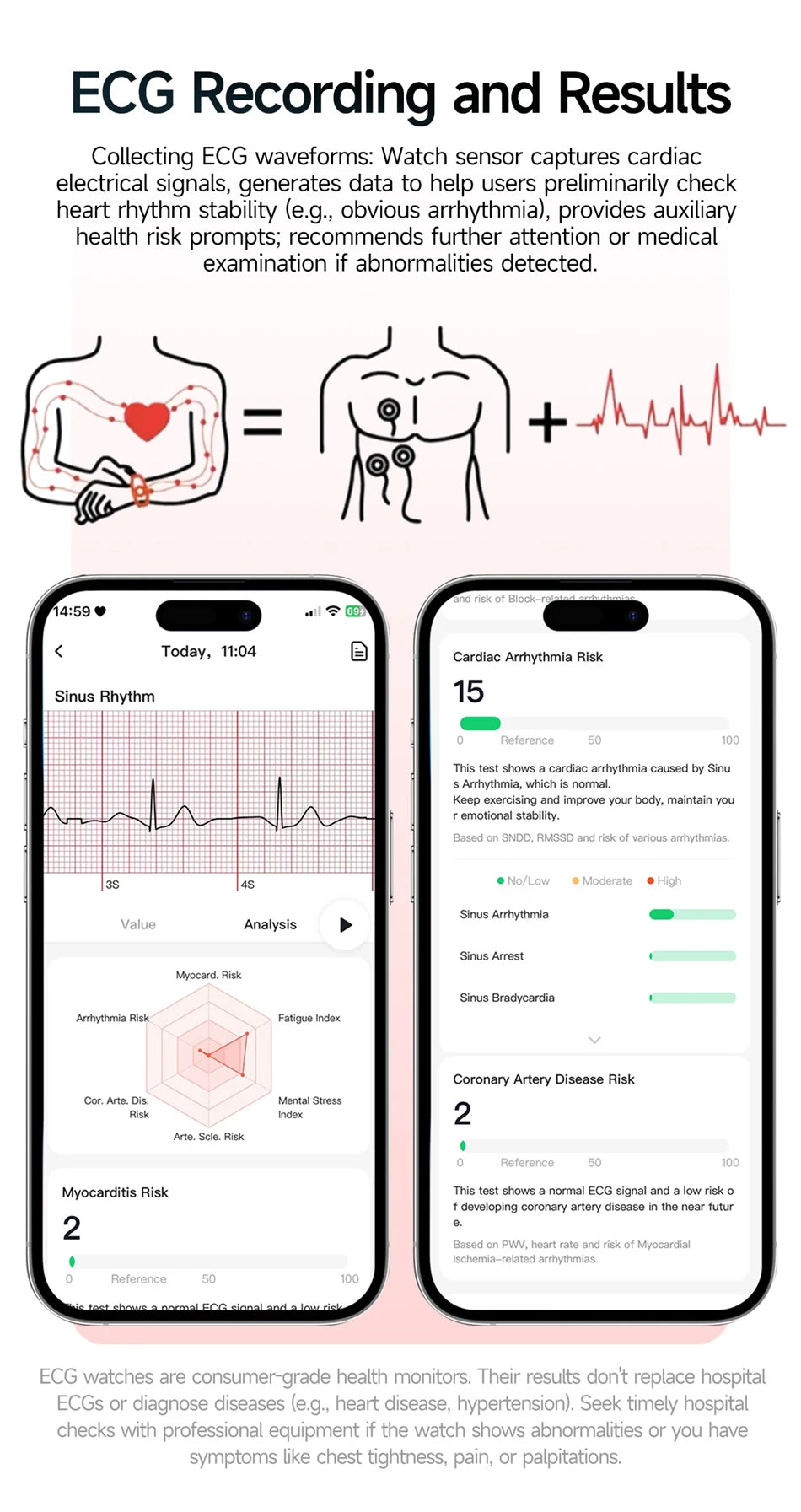 2026 New Health Nursing Grade Smart Watch Men Blood Lipid Uric Acid Tracker ECG+PPG Clock Bluetooth Call Smartwatches Men Women