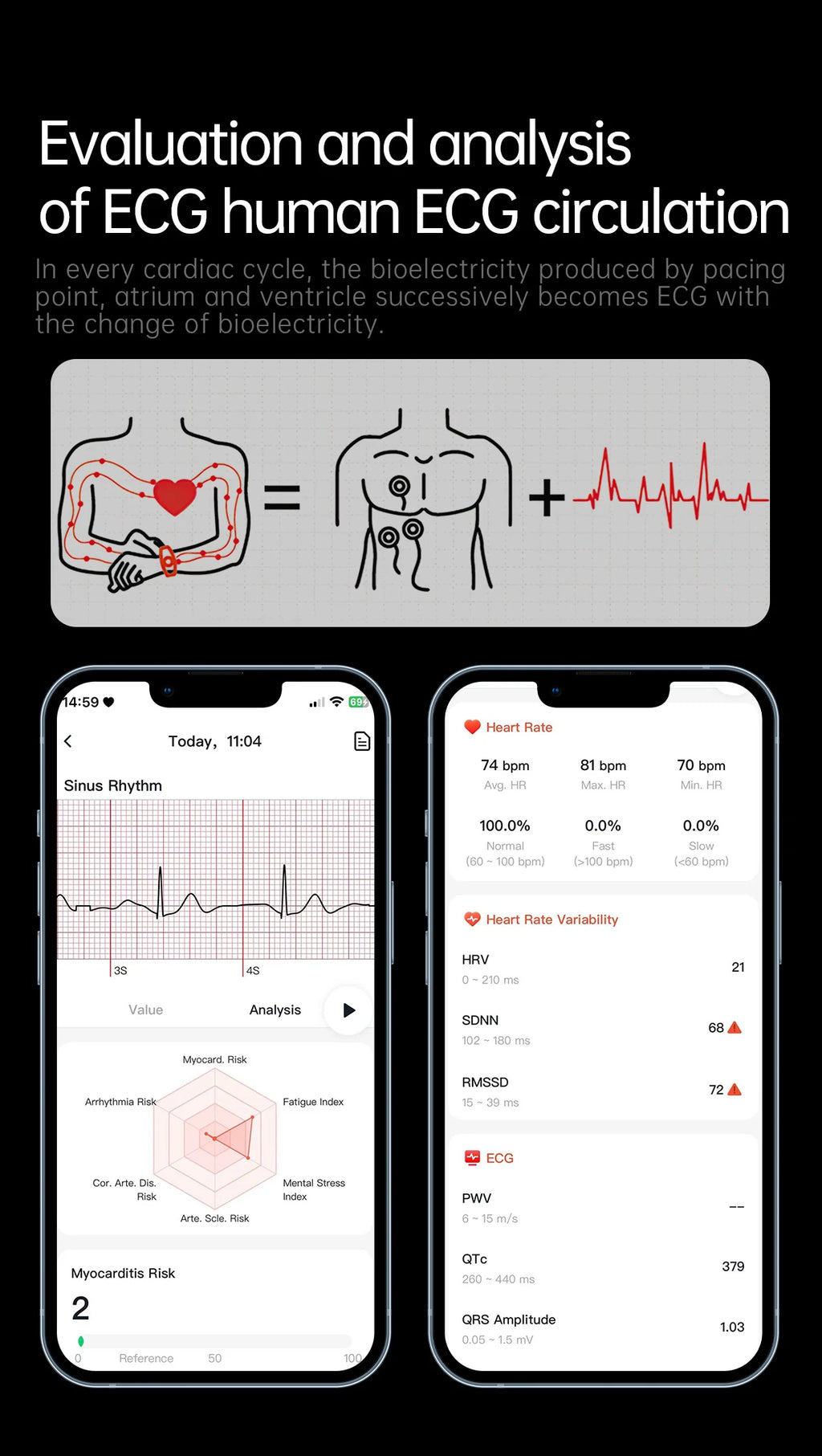 2026 Health Nursing Grade New Blood pressure Smart Watch Men Lipid Uric Acid Tracker ECG+PPG Clock HD Call NFC Smartwatch Women