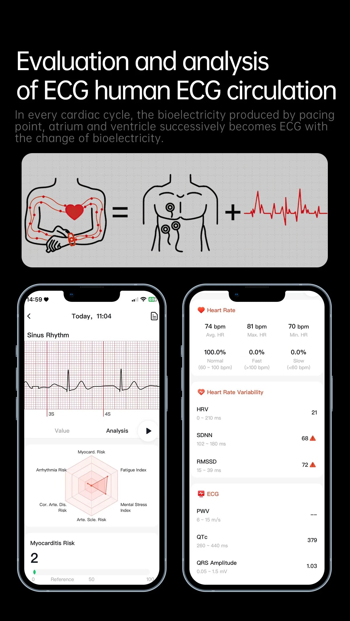 2026 Health Nursing Grade New Blood pressure Smart Watch Men Lipid Uric Acid Tracker ECG+PPG Clock HD Call NFC Smartwatch Women