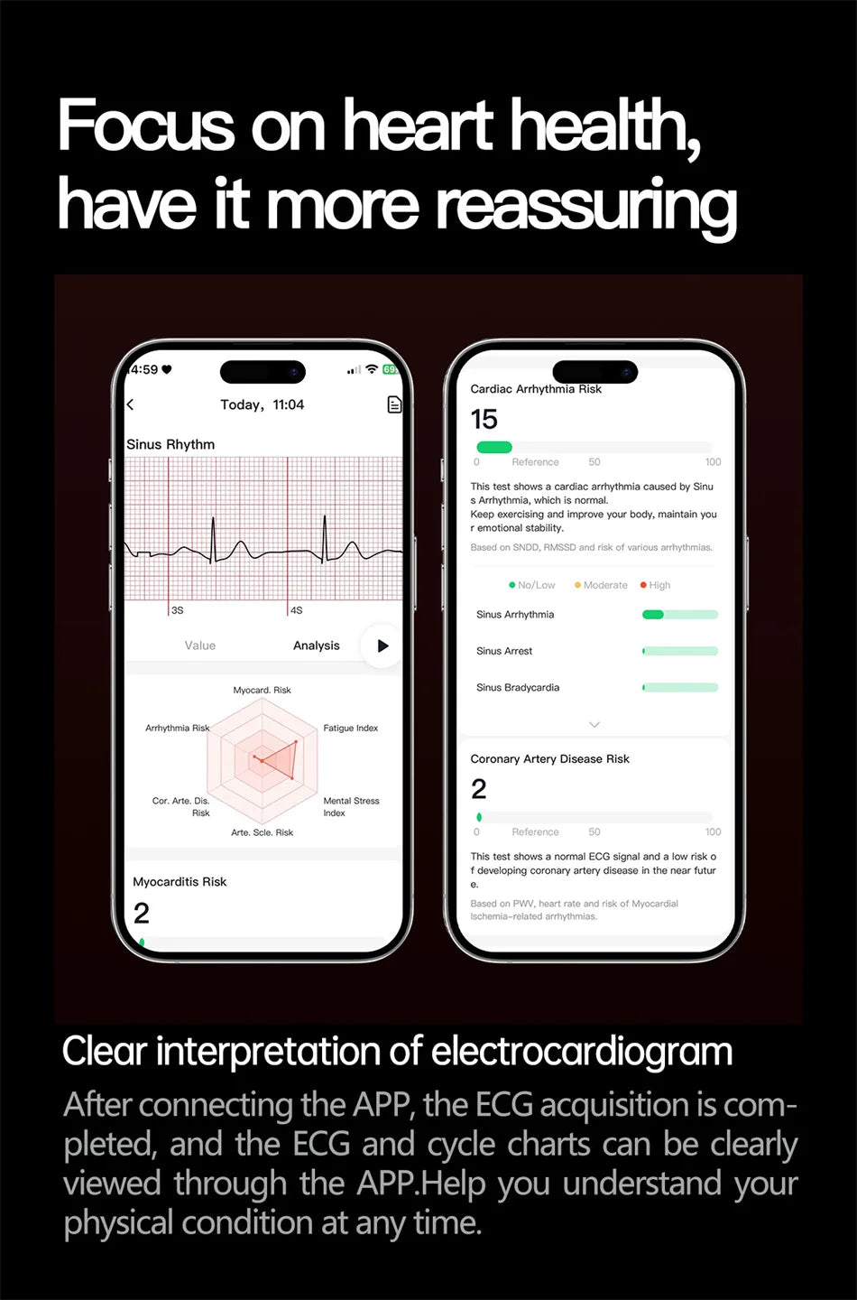 Hospital Level Accurate Measurement Blood Analysis Health Smart Watch ECG Uric Acid Blood Lipids BT Call Smart Watches For man